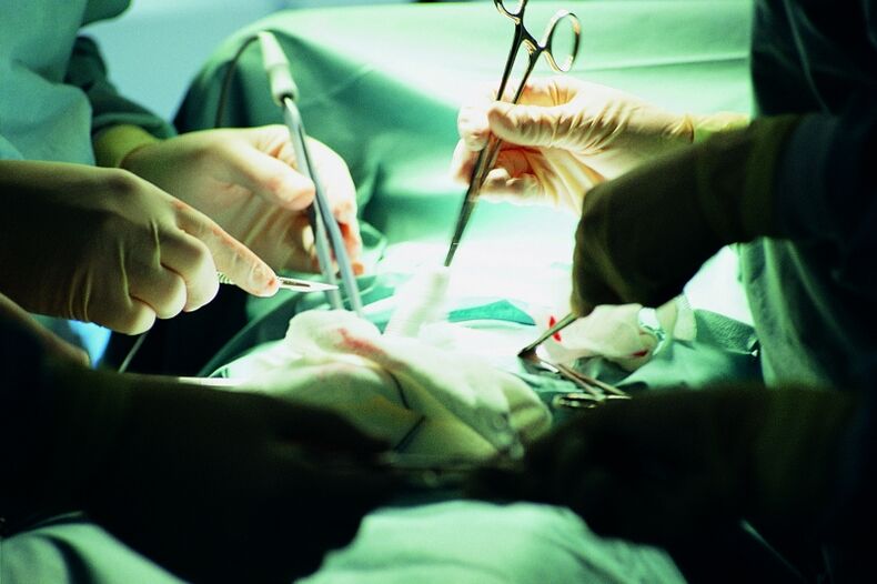 хирургично увеличаване на дебелината на пениса